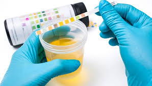 synthetic urine